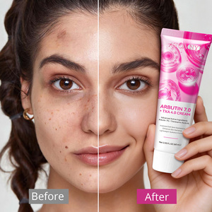 Crema Facial ATOANY con Arbutina 7.0 y TXA 4.0, Hidratante, Corrector de <span class=keywords><strong>Manchas</strong></span> Oscuras, Iluminadora, con Niacinamida - Product Image 1
