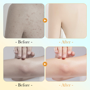 Oem odm 520 מ ל sadoer ויטמין <span class=keywords><strong>C</strong></span> מקלחת ג 'ל הסיטונאי לחות נשים מזין הלבנה vc - Product Image 5