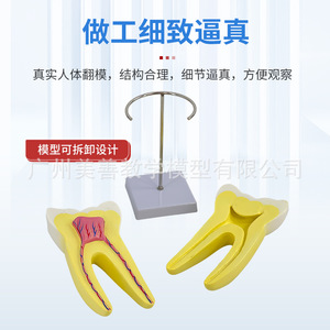 Modelo de dientes incisivos, caninos y molares humanos ampliados 12 veces; herramienta didáctica para el desmontaje anatómico de la pulpa dental y el nervio. - Product Image 3
