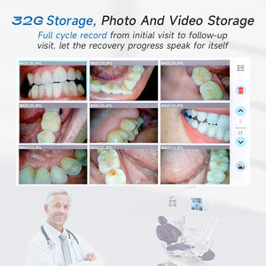 Meiboy pendeteksi gigi HD, pemindai kesehatan gigi genggam dasar Desktop 11 inci tampilan & pegangan - Product Image 5