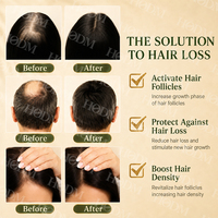 Set Profesional OEM para el Crecimiento del Cabello con Aceite de Romero y Ricino - Fórmula y Empaque Personalizados para Marca de Lujo de Cuidado Capilar de Marca Privada