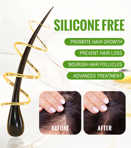 แชมพูทรีทเมนต์สำหรับหัวโล้นแชมพูสำหรับผมหัวโล้น - Product Image 4