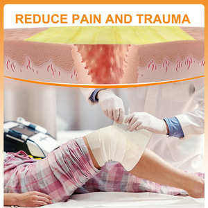 ผ้าพันแผลซีโรฟอร์ม รีเซนเมด สำหรับการดูแลแผลระดับการแพทย์ ให้ความสบายและมีประสิทธิภาพ สำหรับแผลไฟไหม้ - Product Image 4