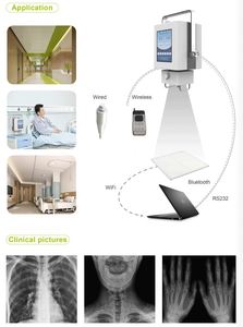 Y tế <span class=keywords><strong>X</strong></span>-<span class=keywords><strong>Ray</strong></span> thiết bị <span class=keywords><strong>x</strong></span>ách tay tần số cao <span class=keywords><strong>x</strong></span> <span class=keywords><strong>Ray</strong></span> máy với phẳng Detector mslgx11 - Product Image 6
