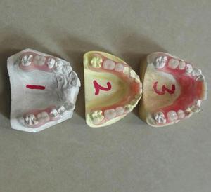 Materiale Acrilico Elastico Flessibile per Protesi Dentali Valplast con Particelle Rosa per Sistema di Iniezione - Product Image 5