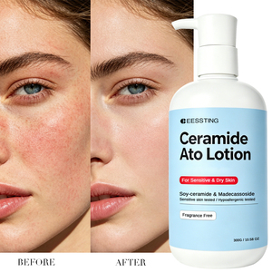Cuidado Corporal de Marca Privada, Suave y Calmante, Reconstruye la Barrera Cutánea, Ceramida Blanqueadora, Loción Corporal con Ceramida Ato - Product Image 2