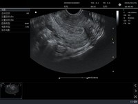 SONOIMAGE N38 Alat USG Doppler Portabel Ramah Pengguna untuk Klinik Hewan Bergerak dan Pemeriksaan Hewan di Lapangan