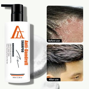 Champú Anticaspa Nutritivo para el Cuero Cabelludo, Fórmula Antifúngica, Revitaliza los Cuero Cabelludos Secos, Elimina las Escamas y Retiene la Humedad - Product Image 5