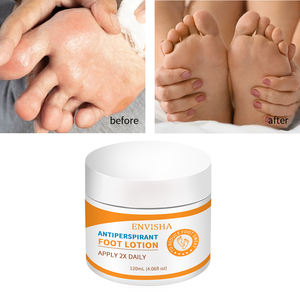 कस्टम लोगो प्राकृतिक जैविक फीट एंटीपर्सपिरेंट क्रीम पुरुषों और महिलाओं के लिए हाथ पैर लोशन - Product Image 2