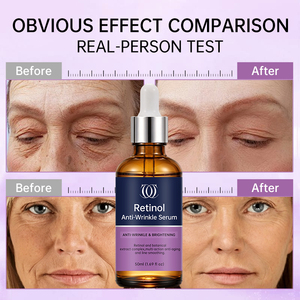Suero de Retinol al por Mayor 50ml <span class=keywords><strong>Antiarrugas</strong></span> y Antimanchas con Ácido Hialurónico para Iluminar y Suavizar - Proveedor - Product Image 2
