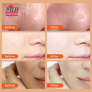 Vitamina C Amino Acido Deep Detergente per la Pulizia del viso Crema Detergente per il Controllo Olio di Fragranza per gli Uomini/Donne di tutta la pelle - Product Image 3