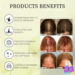 เซรั่มน้ำมันปลูกผมสับปะรดออร์แกนิก30มล. สำหรับผมทุกประเภท - Product Image 4