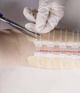 อุปกรณ์ปิดแผลฟิล์ม <span class=keywords><strong>PET</strong></span> แบบใช้แล้วทิ้งอุปกรณ์ป้องกันแผลที่ผิวหนัง - Product Image 3