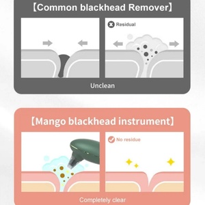 เครื่องดูดสิวเสี้ยนแบบสุญญากาศร้อนและเย็น กำจัดจุดด่างดำ อุปกรณ์ดูแลผิวหน้า - Product Image 4