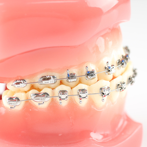 Mehrzweck-Mundhygiene Roth 0.022 Selbst ligier ende kiefer ortho pä dische <span class=keywords><strong>Brackets</strong></span> Edelstahl-Kieferorthopädie - Product Image 2