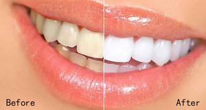 Dc24 Daily Care 100% xylitol <span class=keywords><strong>chewing</strong></span>-<span class=keywords><strong>gum</strong></span> sain bonbons sans sucre <span class=keywords><strong>chewing</strong></span>-<span class=keywords><strong>gum</strong></span> 60 pièces dans une bouteille - Product Image 6