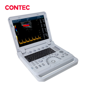 CONTEC CMS1700B Machine à ultrasons <span class=keywords><strong>4d</strong></span> d'occasion - Product Image 1