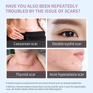 Mayfancy 5g Scar Gel Improve Scar Appearance for Acne Burns Keloids Stretch Marks Skin Care - Product Image 6