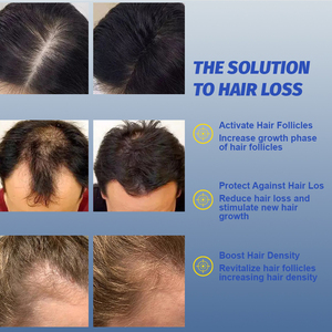 Suero Profesional para el Crecimiento <span class=keywords><strong>del</strong></span> Cabello con Péptidos de Cobre GHK-Cu AHK-Cu para la Caída <span class=keywords><strong>del</strong></span> Cabello y la Línea <span class=keywords><strong>del</strong></span> Cabello en Hombres y Mujeres, Tópico, el Mejor OEM - Product Image 5