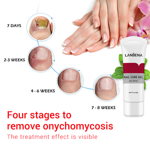 LANBENA - Gel Reparador de Uñas para el Tratamiento de Hongos en las Uñas, Marca Privada - Product Image 2