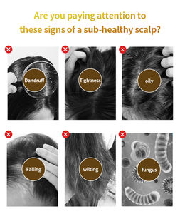 Analizador de Cuero Cabelludo Portátil Multifuncional 5 en 1 de ABS, Máquina para el Cuidado Profundo del Cuero Cabelludo y el Crecimiento del Cabello - Product Image 3