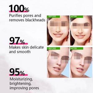 Mascarilla Facial Orgánica <span class=keywords><strong>de</strong></span> <span class=keywords><strong>Aloe</strong></span> <span class=keywords><strong>Vera</strong></span>, Ayuda a Reducir los Signos del Envejecimiento, Hidratante, Elimina los Puntos Negros, Servicio <span class=keywords><strong>de</strong></span> Fabricación OEM para el Cuidado <span class=keywords><strong>de</strong></span> la Piel - Product Image 3