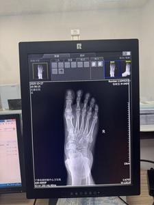 Moniteur médical vétérinaire et chirurgical à rayons X de 21,3 pouces 3MP, fabriqué en Chine pour hôpitaux vétérinaires - Product Image 3