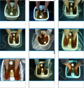 Electric <strong>Ionic</strong> Foot Spa Detox Machine for Home Use - Product Image 4