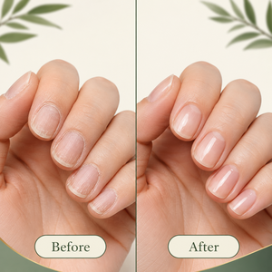 Sérum pour les ongles à l'arbre à thé et au gingembre, 30 ml, marque privée OEM, soin hydratant des cuticules, fortifiant pour les ongles secs, cassants et abîmés - Product Image 5