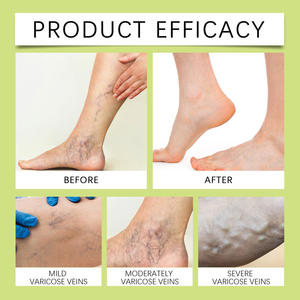 <span class=keywords><strong>Miracle</strong></span> Balm krim pereda nyeri kaki bahu, Balsem pelembap menghaluskan meningkatkan kaku sendi, Krim pereda nyeri kaki bahu - Product Image 3