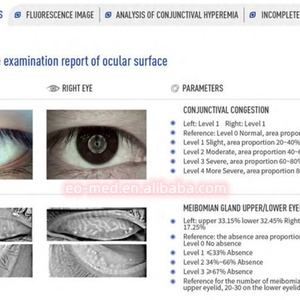 Analyseur complet de diagnostic de la sécheresse oculaire, appareils pour la sécheresse oculaire à vendre DEA60 - Product Image 5