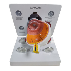 Modelos de Ojos de CIENCIA MÉDICA PARA glaucoma y cataratas - Product Image 5