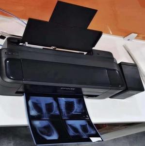 Blue Inkjet Medical Trocken film <span class=keywords><strong>PET</strong></span> Glossy Water proof Rigid für Epson für OKI Fuji Xerox X Ray CT CR DR 210 Mikron - Product Image 6