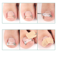 Nouveau kit de correction des ongles incarnés en acier inoxydable avec boucle de traction en silicone et patch adhésif pour la correction des ongles courbés du pied