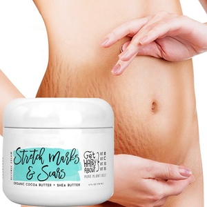 OEM-Crema de eliminación de marcas de estiramiento, sello personalizado de 100ml, mango orgánico natural, crema para el vientre y el embarazo - Product Image 1