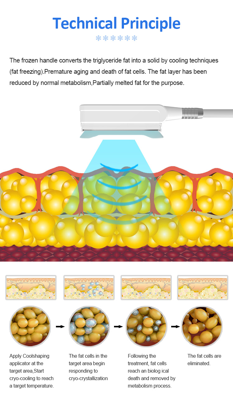  Professional Cryolipolysis Machine