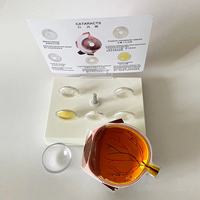 Modèle d'anatomie de l'œil pour la cataracte, démonstration de l'opacité de la lentille, enseignement médical, optique, modèle d'anatomie humaine