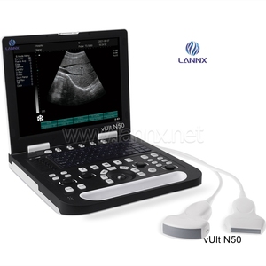 LANNX vUlt N50, équipement médical portable pour animaux, échocardiographie, échographie vétérinaire - Product Image 1