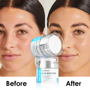 NEW 5D Hyaluronic Acid Wrinkles Anti-aging Snail Anti Age <strong>Moisturising</strong> Whitening Face Moisturizing Antiwrinkle Moisterizer Cream - Product Image 5