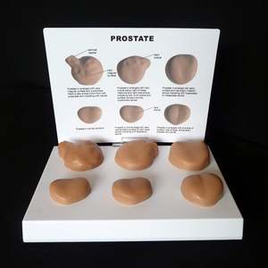KyrenMed laki-laki gelap prostat ujian mandiri Model anatomi medis urologi prostat untuk studi kanker prostat - Product Image 5