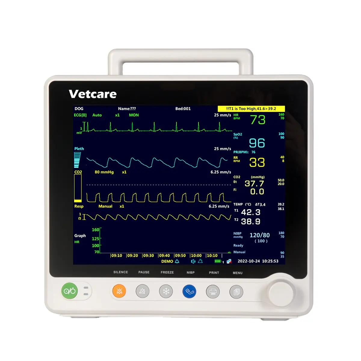 Giá icu quan trọng dấu hiệu màn hình ECG dạng sóng di động CCU đa thông số y tế Màn hình multiparametro bác sĩ thú y bệnh nhân màn hình