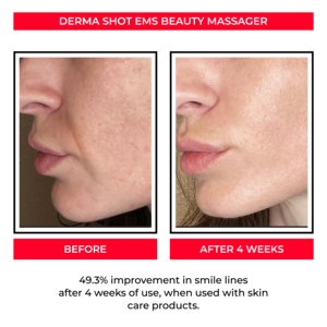 Beauty Unique Y-shaped Design Tighten Pores 3D Face <strong>Massager</strong> ABS Back Massage Body Face <strong>Machine</strong> with Adjustable Intensity