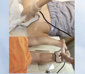 Vet Human <strong>Physiotherapy</strong> 20khz Deep Beauty Body Cellulite Fat Slimming Wrinkle Removal Skincare 448KHZ Tecar Therapy Machine - Product Image 3