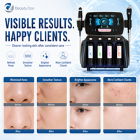 Appareil de soin du visage 2 en 1 Beauty Cos HX-491, technologie d'oxygène CO2, plastique, 1 an de garantie, pour un nettoyage en profondeur des pores, microdermabrasion
