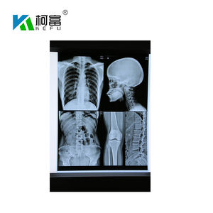 Factory Customized Medical <strong>Blue</strong> Inkjet <strong>Based</strong> Dry <strong>Imaging</strong> Xray <strong>Film</strong> Medical Dry Radiology <strong>Film</strong> - Product Image 2