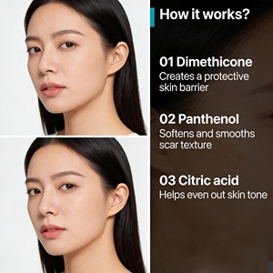 OEM rimozione del segno dell'acne antinfiammatorio migliore riparazione della crema di rimozione della cicatrice dell'acne crema per la rimozione della cicatrice del viso - Product Image 2