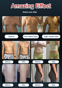 Máquina Profesional de Escultura Corporal NeoRF 2026 con 5 Manijas, 18 Tesla, 8500W, <span class=keywords><strong>para</strong></span> Moldear Músculos y Reafirmar el Suelo Pélvico, <span class=keywords><strong>para</strong></span> Eliminar Grasa - Product Image 5