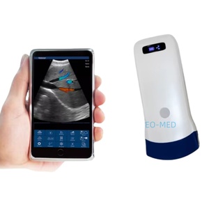 Échographe vétérinaire portable sans fil couleur numérique complète en mode B, 128 éléments, sonde sans fil CU11 - Product Image 1