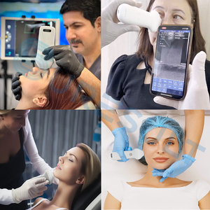 Escáner de ultrasonido estético de mano certificado por la FDA Sonda convexa lineal de 20MHz Para rejuvenecimiento facial y monitoreo de rellenos