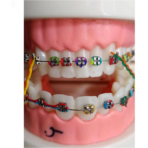 Modules de Ligatig Élastique Dentaire <span class=keywords><strong>Matériaux</strong></span> Orthodontiques Dentaires Double Couleurs Ligature Cravate 1040 Pcs/Sac - Product Image 2